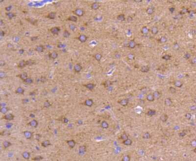 Immunohistochemistry-Paraffin: ATG9A Antibody (SC67-05) [NBP2-67616] - Analysis of paraffin-embedded rat brain tissue using anti-ATG9A antibody. Counter stained with hematoxylin.