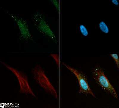 Immunocytochemistry/Immunofluorescence: ATGL Antibody [NB110-41536] - ATGL antibody was tested in HeLa cells with Dylight 488 (green). Nuclei and alpha-tubulin were counterstained with DAPI (blue) and Dylight 550 (red).