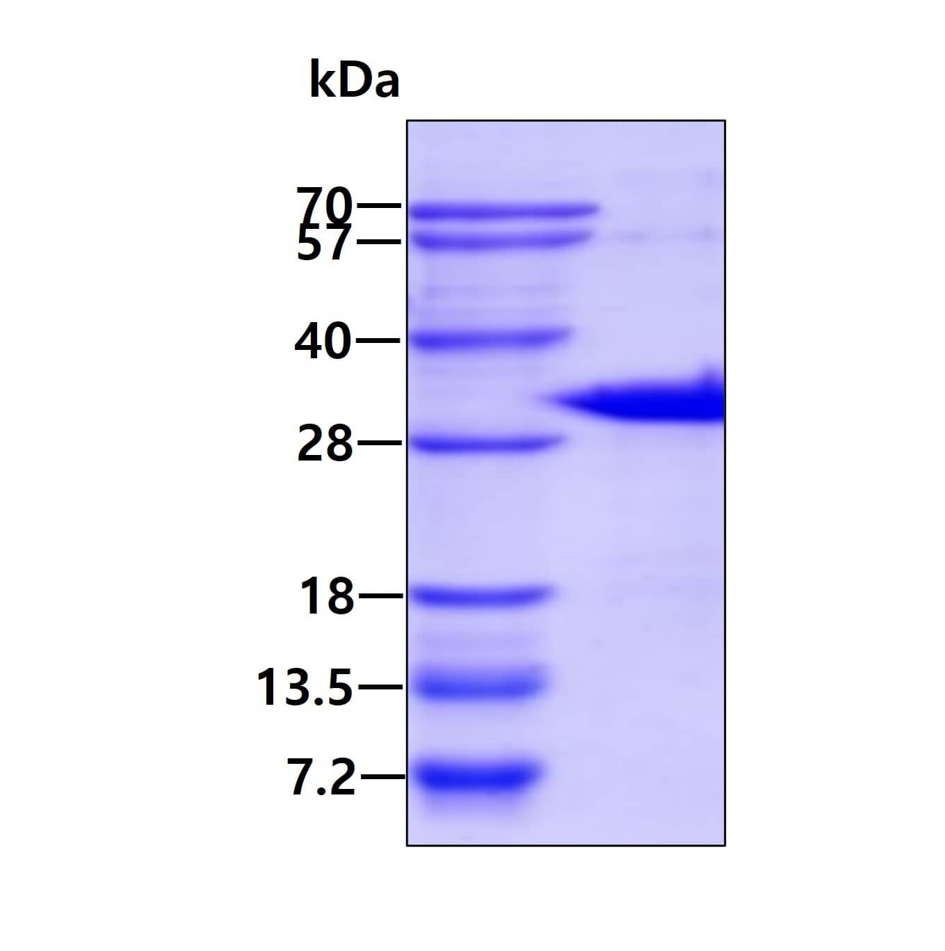 SDS-PAGE Recombinant Human Cited-2 His Protein