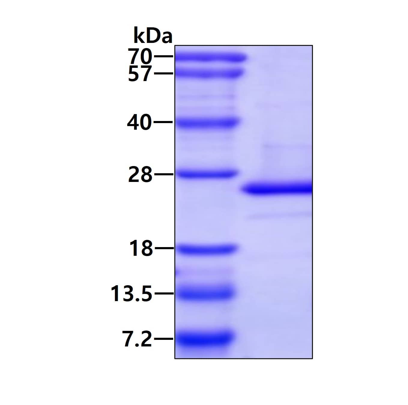 SDS-PAGE Recombinant Human ARL5A His Protein