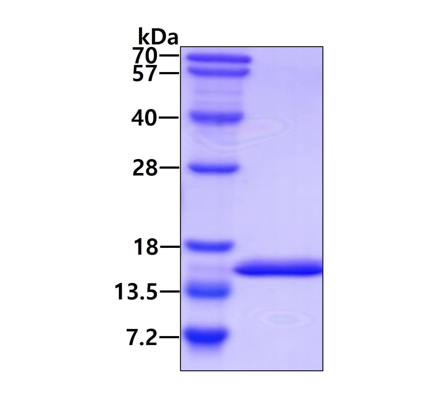SDS-Page: Recombinant Human ROBLD3 Protein [NBP1-50918] - 15 % SDS-PAGE (3ug)
