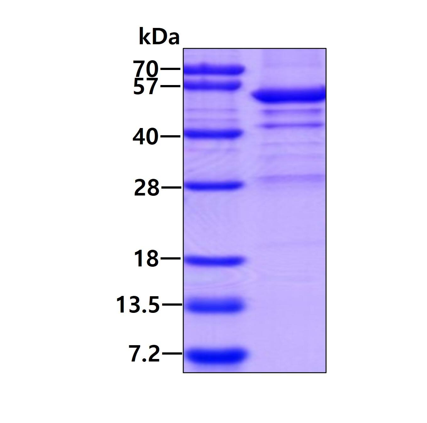 SDS-Page: UMPS Protein [NBP2-22934] - 3ug by SDS-PAGE under reducing condition and visualized by coomassie blue stain.