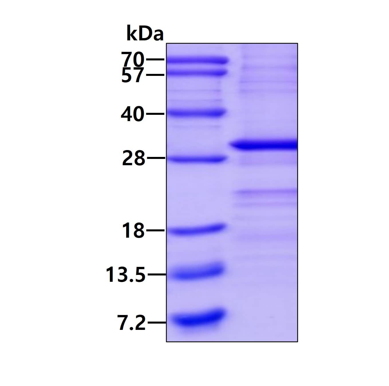 SDS-Page: SSX1 Protein [NBP2-22841] - 3ug by SDS-PAGE under reducing condition and visualized by coomassie blue stain.