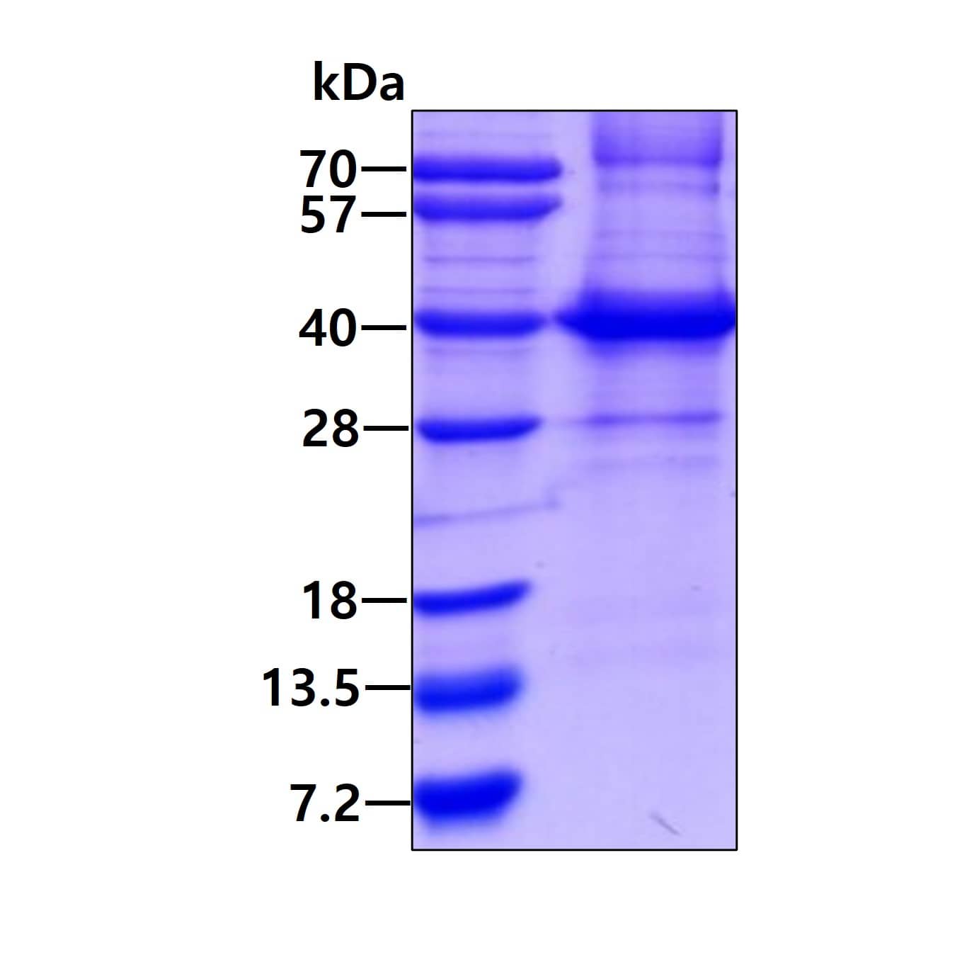 SDS-PAGE Recombinant Human HLA C His Protein