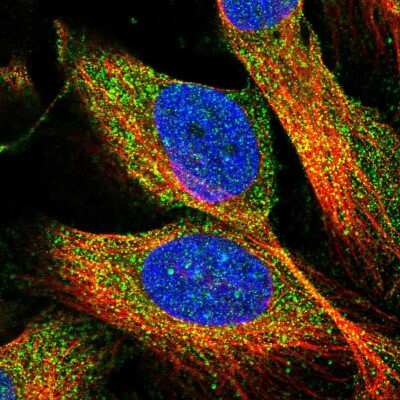 Immunocytochemistry/Immunofluorescence: ATHL1 Antibody [NBP1-93941] - Immunofluorescent staining of human cell line U-2 OS shows localization to cytosol.