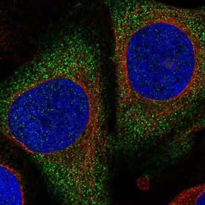 Immunocytochemistry/Immunofluorescence: ATHL1 Antibody [NBP2-58167] - Staining of human cell line U-2 OS shows localization to cytosol.
