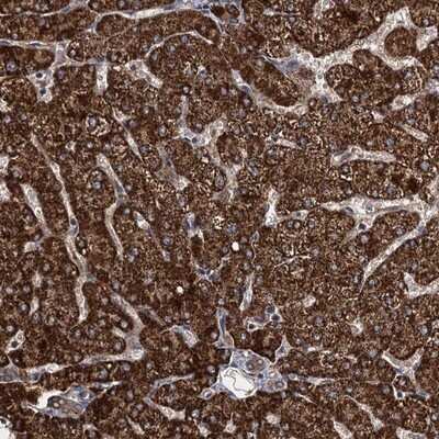 Immunohistochemistry-Paraffin: ATHL1 Antibody [NBP1-93941] - Staining of human liver shows strong cytoplasmic positivity in hepatocytes.