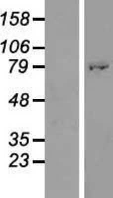 Western Blot: ATHL1 Overexpression Lysate (Adult Normal) [NBP2-06241] Left-Empty vector transfected control cell lysate (HEK293 cell lysate); Right -Over-expression Lysate for ATHL1.