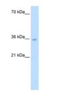 Western Blot: ATIC Antibody [NBP1-56916] - ATIC antibody - middle region validated by WB using Jurkat cell lysate at 5.0 ug/ml.