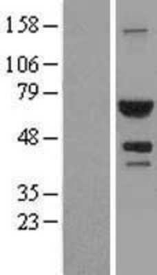 Western Blot: ATIC Overexpression Lysate (Adult Normal) [NBL1-07801] Left-Empty vector transfected control cell lysate (HEK293 cell lysate); Right -Over-expression Lysate for ATIC.