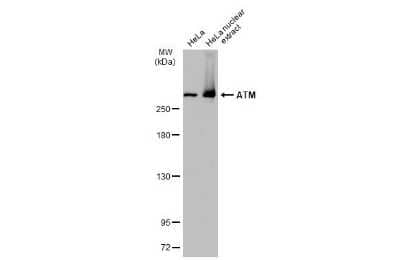 Western Blot: ATM Antibody (2C1-RB) [NBP3-13655] - HeLa whole cell and nuclear extracts (30 ug) were separated by 5% SDS-PAGE, and the membrane was blotted with ATM antibody [2C1-RB] (NBP3-13655) diluted at 1:1000. The HRP-conjugated anti-rabbit IgG antibody (NBP2-19301) was used to detect the primary antibody, and the signal was developed with Trident ECL plus-Enhanced.