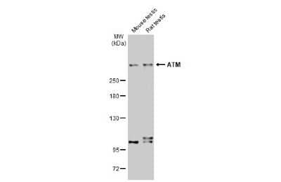 Western Blot: ATM Antibody (2C1-RB) [NBP3-13655] - Various tissue extracts (50 ug) were separated by 5% SDS-PAGE, and the membrane was blotted with ATM antibody [2C1-RB] (NBP3-13655) diluted at 1:1000. The HRP-conjugated anti-rabbit IgG antibody (NBP2-19301) was used to detect the primary antibody.