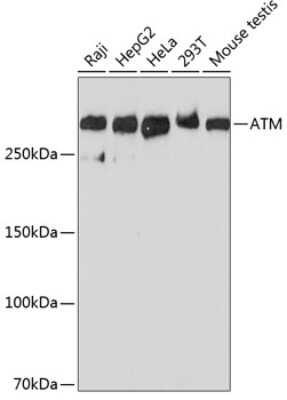 Western Blot: ATM Antibody (6P6C6) [NBP3-15838] - Western blot analysis of extracts of various cell lines, using ATM antibody (NBP3-15838) at 1:1000 dilution. Secondary antibody: HRP Goat Anti-Rabbit IgG (H+L) at 1:10000 dilution. Lysates/proteins: 25ug per lane. Blocking buffer: 3% nonfat dry milk in TBST. Detection: ECL Basic Kit. Exposure time: 90s.