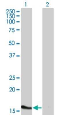 Western Blot ATOH7 Antibody (1E5)