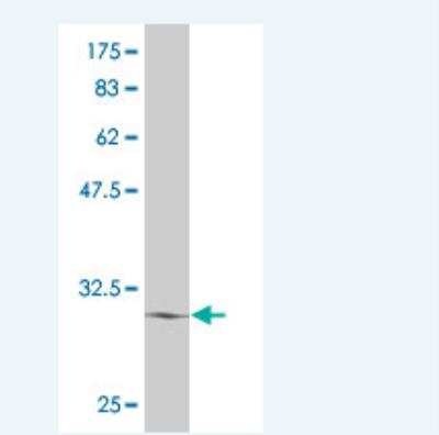 Western Blot ATOH7 Antibody (2B6)