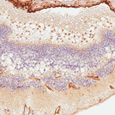 Immunohistochemistry-Paraffin: ATOH7 Antibody [NBP1-88639] - Staining of human eye shows weak to moderate nuclear positivity in the outer nuclear layer of retina.