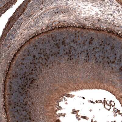 Immunohistochemistry-Paraffin: ATOH7 Antibody [NBP1-88639] - Staining of mouse embryo E14  shows moderate to strong nuclear positivity in a subset of cells in the developing eye retina.