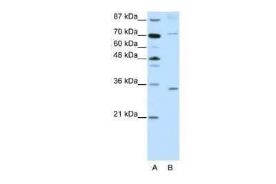 Western Blot: ATOH8 Antibody [NBP2-84478] - WB Suggested Anti-ATOH8 Antibody Titration: 2.5ug/ml. ELISA Titer: 1:12500. Positive Control: Jurkat cell lysate