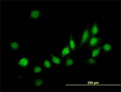 Immunocytochemistry/Immunofluorescence: ATOX1 Antibody (2E6) [H00000475-M01] - Analysis of monoclonal antibody to ATOX1 on HeLa cell. Antibody concentration 10 ug/ml.