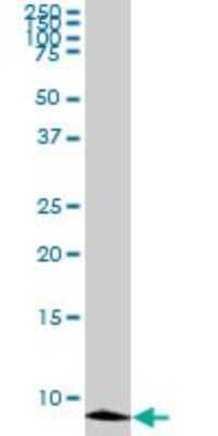 Western Blot: ATOX1 Antibody (2E6) [H00000475-M01] - ATOX1 monoclonal antibody (M01), clone 2E6. Analysis of ATOX1 expression in COLO 320 HSR.