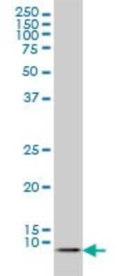 Western Blot: ATOX1 Antibody (2E6) [H00000475-M01] - ATOX1 monoclonal antibody (M01), clone 2E6 Analysis of ATOX1 expression in Hela S3 NE.