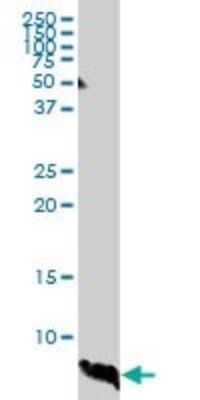 Western Blot ATOX1 Antibody (2E6)