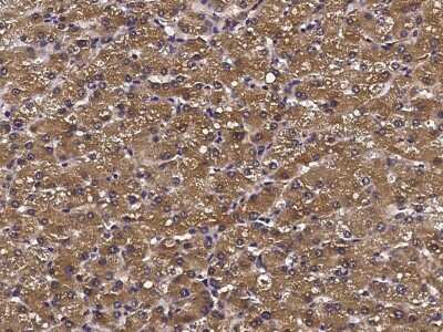 Immunohistochemistry-Paraffin: ATOX1 Antibody [NBP2-97082] - Staining of human ATOX1 in human liver with rabbit polyclonal antibody (1:1000).