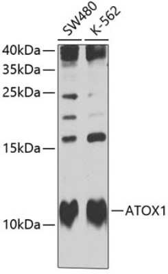 Western Blot: ATOX1 Antibody [NBP2-92669] - Analysis of extracts of various cell lines, using ATOX1 at 1:1000 dilution.Secondary antibody: HRP Goat Anti-Rabbit IgG (H+L) at 1:10000 dilution.Lysates/proteins: 25ug per lane.Blocking buffer: 3% nonfat dry milk in TBST.Detection: ECL Basic Kit .Exposure time: 15s.