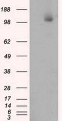 Western Blot: ATP Citrate Lyase Antibody (OTI3G8) [NBP2-02410] -  HEK293T cells were transfected with the pCMV6-ENTRY control (Left lane) or pCMV6-ENTRY ATP Citrate Lyase (Right lane) cDNA for 48 hrs and lysed. Equivalent amounts of cell lysates (5 ug per lane) were separated by SDS-PAGE and immunoblotted with anti-ATP Citrate Lyase.