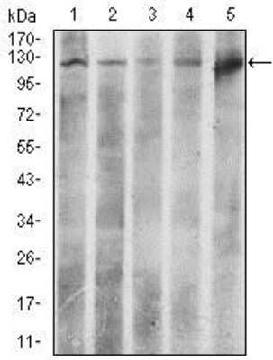 Western Blot: ATP Citrate Lyase Antibody (5F8D11) [NBP2-37429] - Western blot analysis using ACLY mouse mAb against HeLa (1), NIH3T3 (2), C6 (3), COS7 (4), and Raji (5) cell lysate.