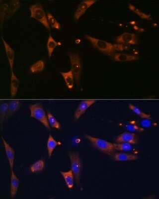 Immunocytochemistry/Immunofluorescence: ATP Citrate Lyase Antibody (8A0V0) [NBP3-16261] - Immunofluorescence analysis of NIH-3T3 cells using ATP Citrate Lyase Rabbit mAb (NBP3-16261) at dilution of 1:100 (40x lens). Blue: DAPI for nuclear staining.