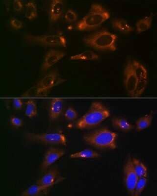 Immunocytochemistry/Immunofluorescence: ATP Citrate Lyase Antibody (8A0V0) [NBP3-16261] - Immunofluorescence analysis of U-2 OS cells using ATP Citrate Lyase Rabbit mAb (NBP3-16261) at dilution of 1:100 (40x lens). Blue: DAPI for nuclear staining.