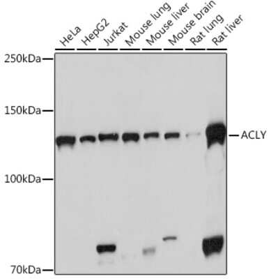 Western Blot: ATP Citrate Lyase Antibody (8A0V0) [NBP3-16261] - Western blot analysis of extracts of various cell lines, using ATP Citrate Lyase Rabbit mAb (NBP3-16261) at 1:1000 dilution. Secondary antibody: HRP Goat Anti-Rabbit IgG (H+L) at 1:10000 dilution. Lysates/proteins: 25ug per lane. Blocking buffer: 3% nonfat dry milk in TBST. Detection: ECL Basic Kit. Exposure time: 3s.