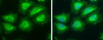 Immunocytochemistry/Immunofluorescence: ATP Citrate Lyase Antibody [NBP1-33430] - HeLa cells were fixed in ice-cold MeOH for 5 min. Green: ATP citrate lyase protein stained by ATP citrate lyase antibody [C2C3], C-term diluted at 1:200. Blue: Hoechst 33342 staining.