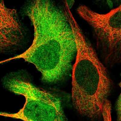 Immunocytochemistry/Immunofluorescence: ATP Citrate Lyase Antibody [NBP1-90268] - Staining of human cell line U-2 OS shows localization to nucleoplasm, plasma membrane & cytosol.