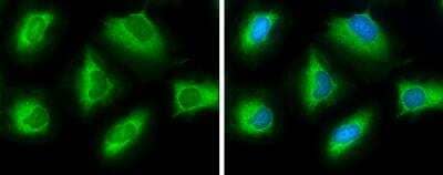 Immunocytochemistry/Immunofluorescence: ATP Citrate Lyase Antibody [NBP2-15510] - ATP Citrate Lyase Antibody detects ATP Citrate Lyase protein at cytoplasm by immunofluorescent analysis. Sample: HeLa cells were fixed in ice-cold MeOH for 5 min. Green: ATP Citrate Lyase protein stained by ATP Citrate Lyase Antibody diluted at 1:500. Blue: Hoechst 33342 staining.