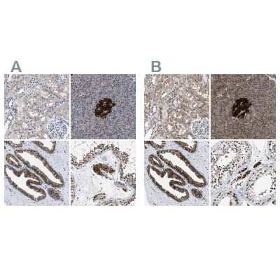 <b>Independent Antibodies Validation and Genetic Strategies Validation.</b>Immunohistochemistry-Paraffin: ATP Citrate Lyase Antibody [NBP1-90266] - Staining of human kidney, pancreas, prostate and testis using Anti-ACLY antibody NBP1-90266 (A) shows similar protein distribution across tissues to independent antibody NBP1-90268 (B).