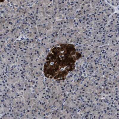 Immunohistochemistry-Paraffin: ATP Citrate Lyase Antibody [NBP1-90266] - Staining of human pancreas shows strong cytoplasmic positivity in islets of Langerhans.