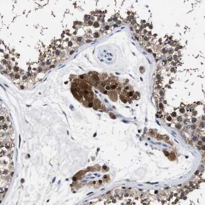 Immunohistochemistry-Paraffin: ATP Citrate Lyase Antibody [NBP1-90266] - Staining of human testis shows strong cytoplasmic positivity in Leydig cells.