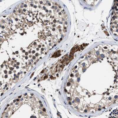 Immunohistochemistry-Paraffin: ATP Citrate Lyase Antibody [NBP1-90267] - Staining of human testis shows strong cytoplasmic positivity in Leydig cells.