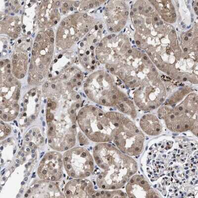 Immunohistochemistry-Paraffin: ATP Citrate Lyase Antibody [NBP1-90268] - Staining of human kidney shows moderate cytoplasmic positivity in cells in tubules.