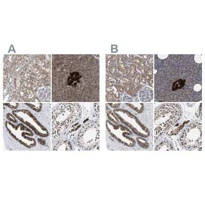 Immunohistochemistry-Paraffin: ATP Citrate Lyase Antibody [NBP1-90268] - Staining of human kidney, pancreas, prostate and testis using Anti-ACLY antibody NBP1-90268 (A) shows similar protein distribution across tissues to independent antibody NBP1-90267 (B).