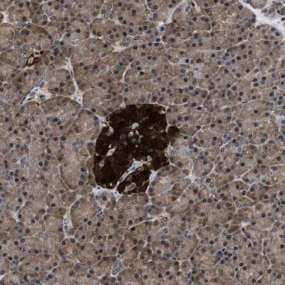 Immunohistochemistry-Paraffin: ATP Citrate Lyase Antibody [NBP1-90268] - Staining of human pancreas shows strong cytoplasmic positivity in islets of Langerhans.