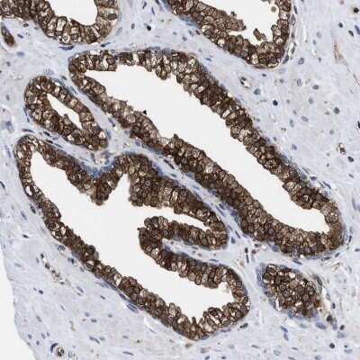 Immunohistochemistry-Paraffin: ATP Citrate Lyase Antibody [NBP1-90268] - Staining of human prostate shows strong cytoplasmic positivity in glandular cells.