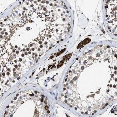 Immunohistochemistry-Paraffin: ATP Citrate Lyase Antibody [NBP1-90268] - Staining of human testis shows strong cytoplasmic positivity in Leydig cells.