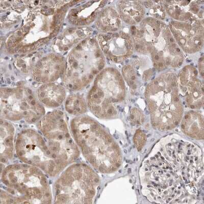 Immunohistochemistry-Paraffin: ATP Citrate Lyase Antibody [NBP1-90269] - Staining of human kidney shows moderate cytoplasmic positivity in cells in tubules.