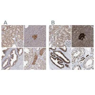 <b>Independent Antibodies Validation. </b>Immunohistochemistry-Paraffin: ATP Citrate Lyase Antibody [NBP1-90269] - Staining of human kidney, pancreas, prostate and testis using Anti-ACLY antibody NBP1-90269 (A) shows similar protein distribution across tissues to independent antibody NBP1-90268 (B).