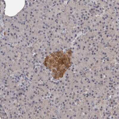 Immunohistochemistry-Paraffin: ATP Citrate Lyase Antibody [NBP1-90269] - Staining of human pancreas shows moderate cytoplasmic positivity in islets of Langerhans.