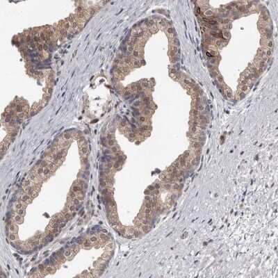 Immunohistochemistry-Paraffin: ATP Citrate Lyase Antibody [NBP1-90269] - Staining of human prostate shows weak cytoplasmic positivity in glandular cells.