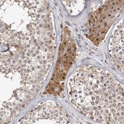 <b>Independent Antibodies Validation. </b>Immunohistochemistry-Paraffin: ATP Citrate Lyase Antibody [NBP1-90269] - Staining of human testis shows moderate cytoplasmic positivity in Leydig cells.